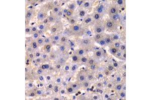 Immunohistochemistry (IHC) image for anti-Inhibitor of kappa Light Polypeptide Gene Enhancer in B-Cells, Kinase gamma (IKBKG) (AA 1-419) antibody (ABIN3021151)