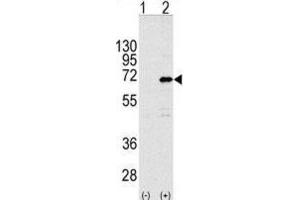 Western Blotting (WB) image for anti-CCR4-NOT Transcription Complex Subunit 4 (CNOT4) antibody (ABIN2998121) (CNOT4 anticorps)