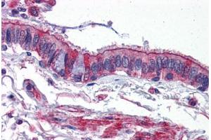 Anti-ACVR1 antibody IHC staining of human lung.