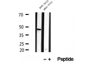 Western blot analysis of extracts of mouse testis tissue, using BBS5 antibody. (BBS5 anticorps  (C-Term))