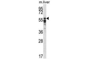 Western blot analysis of PPP2R5A Antibody (C-term) in mouse liver tissue lysates (35ug/lane). (PPP2R5A anticorps  (C-Term))