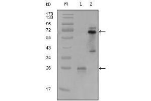Western Blot showing SYK antibody used against truncated SYK-His recombinant protein (1) and PMA induced THP-1 cell lysate (2). (SYK anticorps  (AA 296-484))