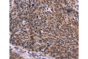 Immunohistochemistry (IHC) image for anti-CDC5 Cell Division Cycle 5-Like (S. Pombe) (CDC5L) antibody (ABIN5548137) (CDC5L anticorps)