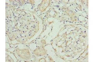 Immunohistochemistry of paraffin-embedded human kidney tissue using ABIN7168530 at dilution of 1:100