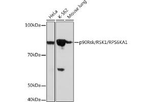 Western blot analysis of extracts of various cell lines, using p90Rsk/RSK1/RPS6K Rabbit mAb (ABIN1681116, ABIN3019149, ABIN3019150 and ABIN7101723) at 1:1000 dilution. (RPS6KA1 anticorps)