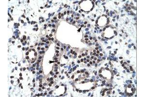 Image no. 1 for anti-Zinc Finger and BTB Domain Containing 45 (ZBTB45) (AA 200-249) antibody (ABIN6735917) (ZBTB45 anticorps  (AA 200-249))