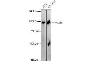 PPM1E anticorps