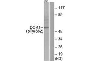 Western blot analysis of extracts from 293 cells, using p62 Dok (Phospho-Tyr362) Antibody. (DOK1 anticorps  (pTyr362))