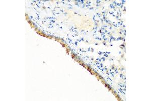 Immunohistochemistry of paraffin-embedded mouse lung using CBL antibody at dilution of 1:200 (40x lens). (CBL anticorps)