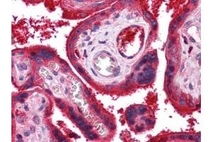 Human Placenta: Formalin-Fixed, Paraffin-Embedded (FFPE) (C9 anticorps)
