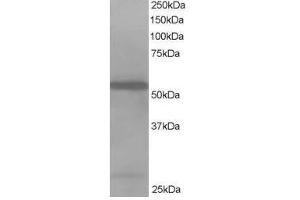 Image no. 1 for anti-Drebrin-Like (DBNL) (N-Term) antibody (ABIN374214) (DBNL anticorps  (N-Term))