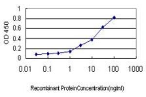 Detection limit for recombinant GST tagged TOP1 is approximately 0.