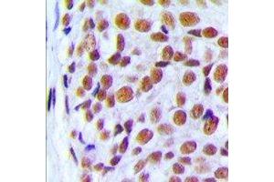 anti-PRP6 Pre-mRNA Processing Factor 6 Homolog (PRPF6) (C-Term) antibody