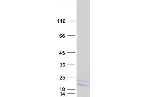 Validation with Western Blot