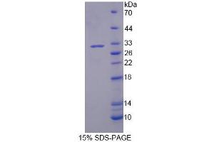 SDS-PAGE (SDS) image for Phospholipase A2, Group III (PLA2G3) (AA 20-268) protein (His tag) (ABIN4990039) (PLA2G3 Protein (AA 20-268) (His tag))