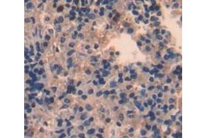 IHC-P analysis of Kidney tissue, with DAB staining. (STAP1 anticorps  (AA 1-297))