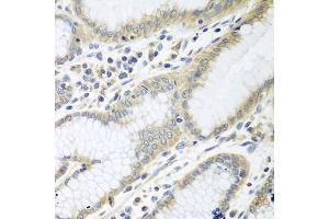 Immunohistochemistry of paraffin-embedded human stomach using RPN2 antibody (ABIN5974836) at dilution of 1/100 (40x lens). (Ribophorin II anticorps)