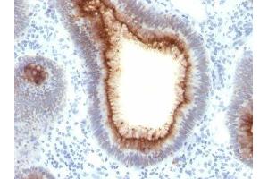 Image no. 1 for anti-Carcinoembryonic Antigen-Related Cell Adhesion Molecule 5 (CEACAM5) antibody (ABIN6151894) (CEACAM5 anticorps)