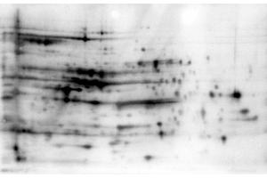 2D Western Blot of anti-E. (HCP anticorps)