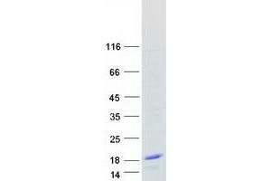 Validation with Western Blot