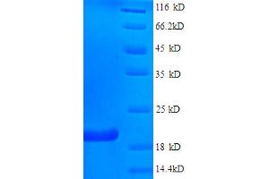 SDS-PAGE (SDS) image for Fragile Histidine Triad (FHIT) (AA 2-147) protein (His tag) (ABIN5712778) (FHIT Protein (AA 2-147) (His tag))