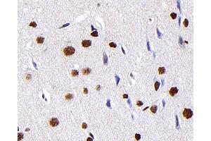 Immunohistochemistry analysis of paraffin-embedded Rat brain using S100A4 Monoclonal Antibody at dilution of 1:300. (s100a4 anticorps)