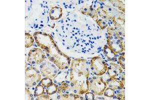 Immunohistochemistry of paraffin-embedded mouse kidney using COMT antibody. (COMT anticorps)