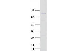 Validation with Western Blot