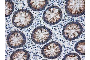 Image no. 2 for anti-Adenylate Kinase 4 (AK4) antibody (ABIN1496525)