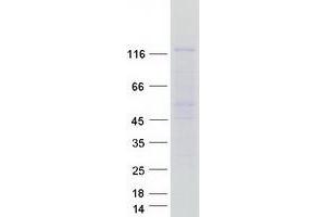 Validation with Western Blot