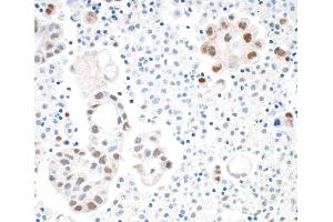 Immunohistochemistry (IHC) image for anti-Signal Transducer and Activator of Transcription 3 (Acute-Phase Response Factor) (STAT3) (AA 175-225) antibody (ABIN7455098)
