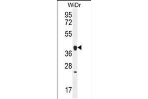 Western blot analysis in WiDr cell line lysates (35ug/lane). (OR2T8 anticorps  (C-Term))
