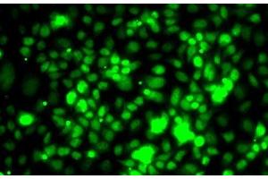 Immunofluorescence analysis of MCF7 cells using TCEB3 Polyclonal Antibody (TCEB3 anticorps)