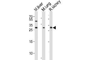 Western blot analysis of lysates from mouse liver, mouse lung, rat kidney tissue lysate (from left to right), using SOST Antibody (N-term) (ABIN390193 and ABIN2840682). (Sclerostin anticorps  (N-Term))