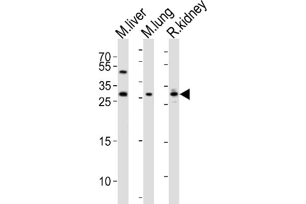 Sclerostin anticorps  (N-Term)
