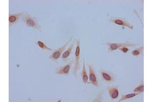 Immunocytochemistry analysis of Hela cells using ABIN7139184 at dilution of 1:100