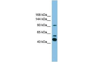 WB Suggested Anti-PLA2G4E Antibody Titration: 0.