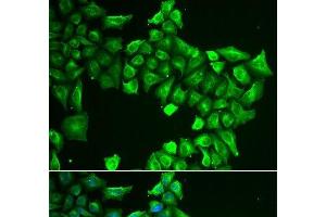 Immunofluorescence analysis of HeLa cells using ASL Polyclonal Antibody (ASL anticorps)