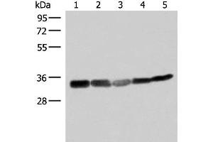 Western blot analysis of 293T HepG2 and A549 cell lysates using ECH1 Polyclonal Antibody at dilution of 1:200 (ECH1 anticorps)