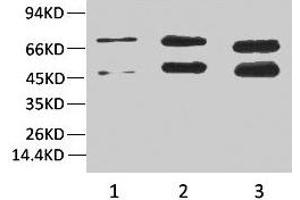 Western blot analysis of 1) Hela, 2)Rat Brain Tissue, 3) Mouse Brain Tissue with Phosphoserine Mouse mAb diluted at 1:2000. (Phosphoserine anticorps)