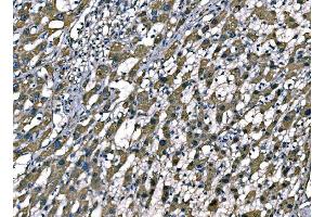 IHC analysis of SOD2 using anti-SOD2 antibody (ABIN7602799).