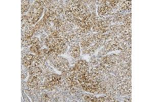 IHC analysis of CYP2C19 using anti-CYP2C19 antibody (ABIN6719471).