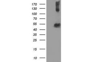 Western Blotting (WB) image for anti-Tubulin beta 4a (TUBB4A) antibody (ABIN1501580) (TUBB4 anticorps)