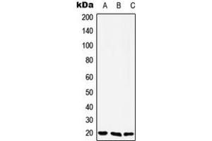 Western blot analysis of YAF2 expression in Jurkat (A), Raw264. (YAF2 anticorps  (N-Term))