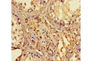 Immunohistochemistry of paraffin-embedded human testis tissue using ABIN7142130 at dilution of 1:100 (RNASEL anticorps  (AA 330-741))
