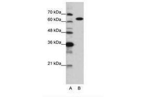 Image no. 1 for anti-Lysyl-tRNA Synthetase (KARS) (C-Term) antibody (ABIN6749717) (KARS anticorps  (C-Term))