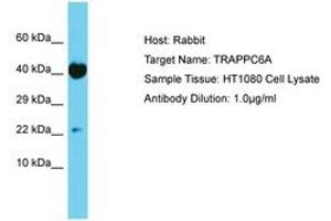 Image no. 1 for anti-Trafficking Protein Particle Complex 6A (TRAPPC6A) (AA 21-70) antibody (ABIN6750666) (TRAPPC6A anticorps  (AA 21-70))