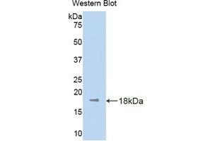 Western blot analysis of the recombinant protein. (KIF5A anticorps  (AA 473-605))