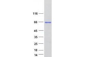 Validation with Western Blot