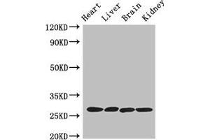 Western Blot Positive WB detected in: Mouse heart tissue, Mouse liver tissue, Mouse brain tissue, Mouse kidney tissue All lanes: PRSS2 antibody at 3 μg/mL Secondary Goat polyclonal to rabbit IgG at 1/50000 dilution Predicted band size: 27 kDa Observed band size: 27 kDa (PRSS2 anticorps  (AA 24-247))